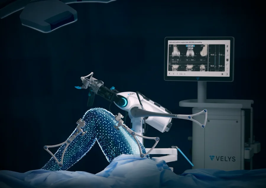 Sistem bedah robotik dengan navigasi digital dan model lutut tiga dimensi di layar perencanaan operasi